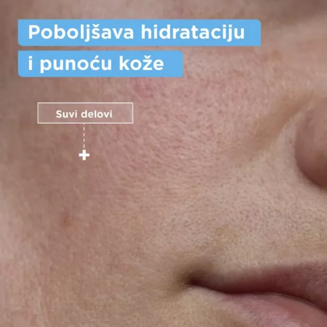 MIXA GEL ZA ČIŠĆENJE LICA PROTIV SUVOĆE KOŽE 150ML