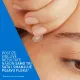 CeraVe Flasteri protiv nepravilnosti A22