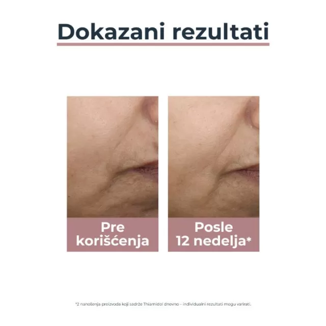 EUCERIN ANTI-PIGMENT TONIRANA DNEVNA KREMA SPF30 TAMNA 50ML