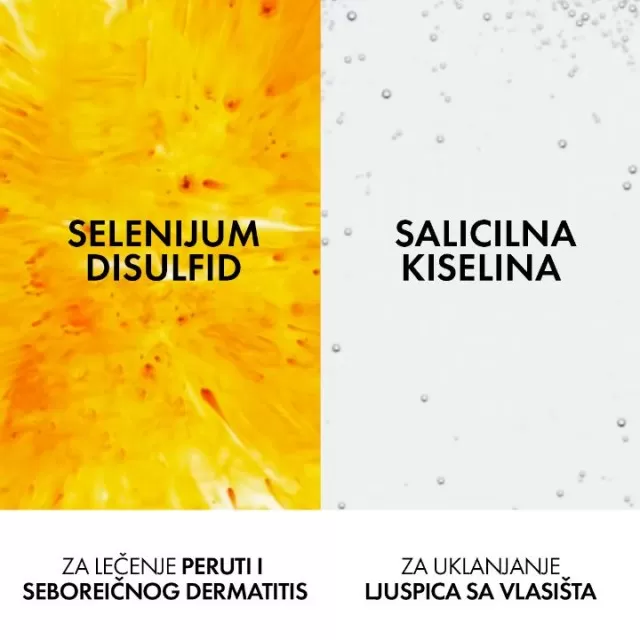 VICHY DERCOS Izuzetno smirujući šampon za osetljivo vlasište, normalna do masna kosa, 390 ml