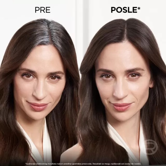 LOREAL MAGIC RETOUCH SPREJ ZA PRIKRIVANJE IZRASTKA 7 COLD BROWN 75ML