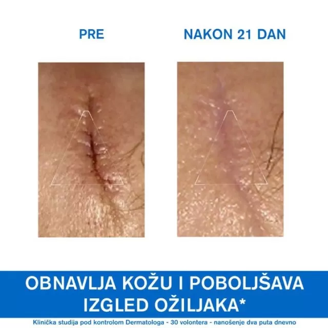 URIAGE BARIEDERM CICA KREMA 40ML