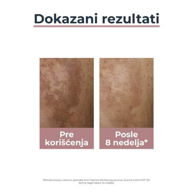 EUCERIN ANTI-PIGMENT DNEVNA KREMA SPF30 50 ML