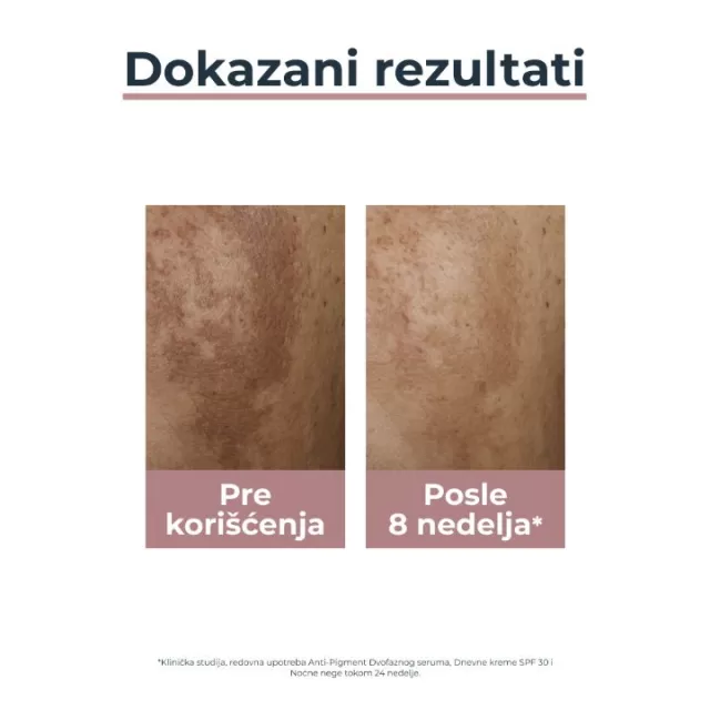 EUCERIN ANTI-PIGMENT NOĆNA KREMA 50 ML