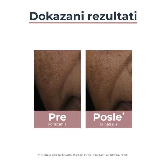 EUCERIN ANTI-PIGMENT KOREKTOR 5ML