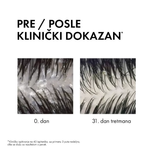 Vichy Dercos šampon protiv peruti DS 2u1 , 390 ml