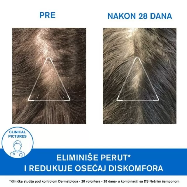 URIAGE D.S. ŠAMPON PROTIV PERUTI 200ML