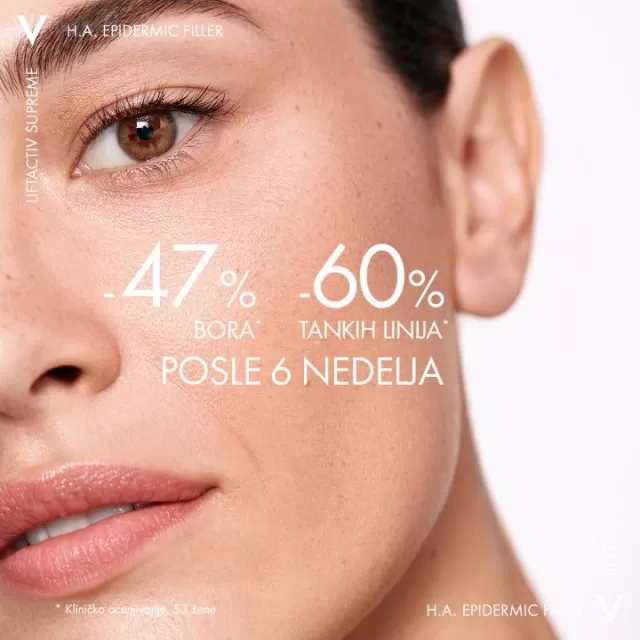 VICHY LIFTACTIV SUPREME H.A. EPIDERMIC FILLER za punoću kože i efekat popunjavanja bora i tankih linja, 1,5% čiste hijaluronske kiseline, 30 ml
