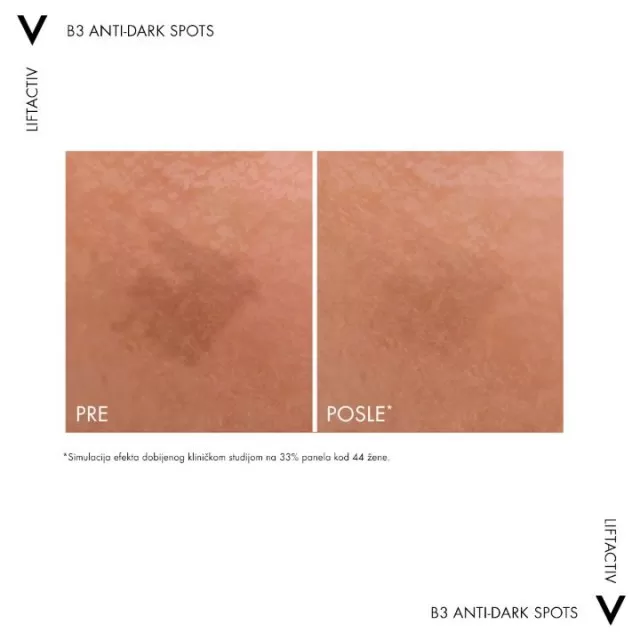VICHY LIFTACTIV SPECIALIST B3 DARK SPOTS SERUM, serum protiv tamnih hiperpigmentacijskih fleka i bora, 30 ml