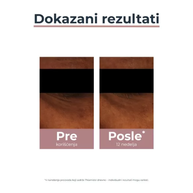 EUCERIN ANTI-PIGMENT KREMA ZA TAMNE KOLUTOVE OKO OČIJU 15ML