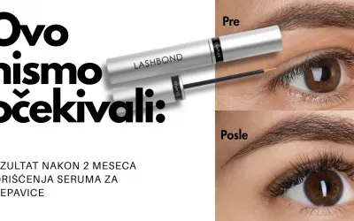 Testirali smo serum za trepavice koji vole dermatolozi i oftalmolozi tokom 2 meseca i dao je rezultat: XL trepavice bez ikakvih nuspojava