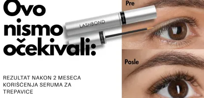 Testirali smo serum za trepavice koji vole dermatolozi i oftalmolozi tokom 2 meseca i dao je rezultat: XL trepavice bez ikakvih nuspojava