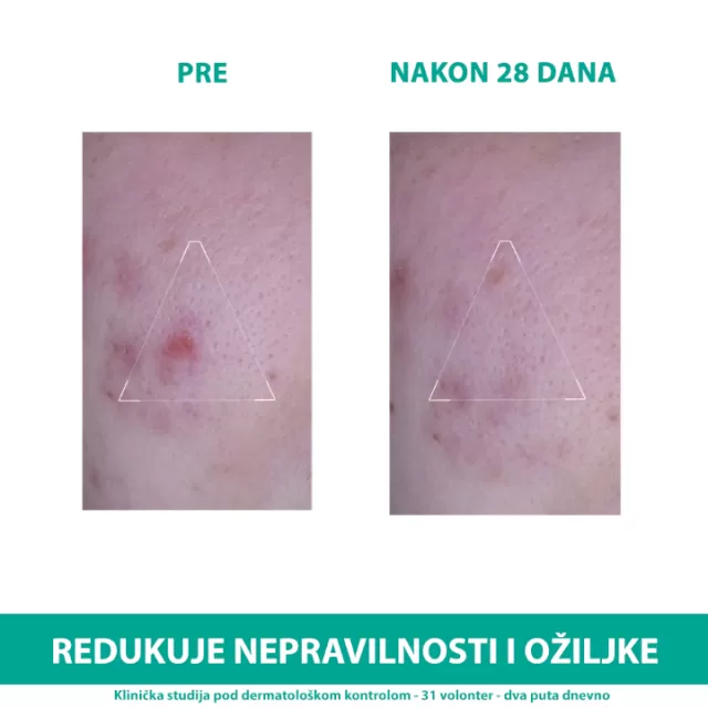 URIAGE HYSEAC 3-REGUL PLUS KREMA 40ML
